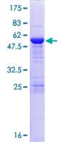Human ACRP / SPAG7 Protein (Recombinant GST)
