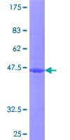 Human ITGB1BP1 / ICAP1 Protein (Recombinant GST)