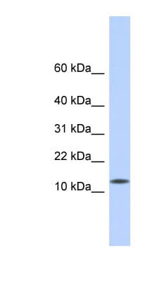 CDRT4 Antibody (aa35-84)