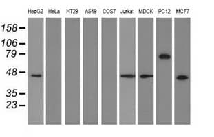 KIAA0517 / TRIM2 Antibody (clone OTI4E5)