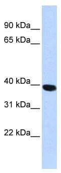 HYAL1 Antibody (aa36-85)
