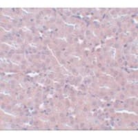 Polyclonal Rabbit anti-Human FRMPD2 Antibody (IHC, WB)