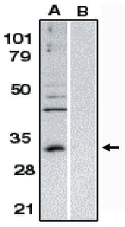 PathPlus™ BCL10 / BCL-10 Antibody (aa5-19)