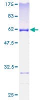 Human BM022 / MRPL1 Protein (Recombinant GST)