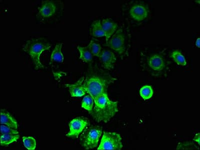 CMTR2 / FTSJD1 Antibody