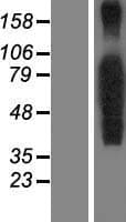 FOXP4 Protein (Over-Expression Lysate Myc-DDK (Flag))