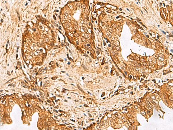 DHRS2 / HEP27 Antibody