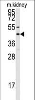 GJA8 / CX50 / Connexin 50 Antibody (aa402-433)