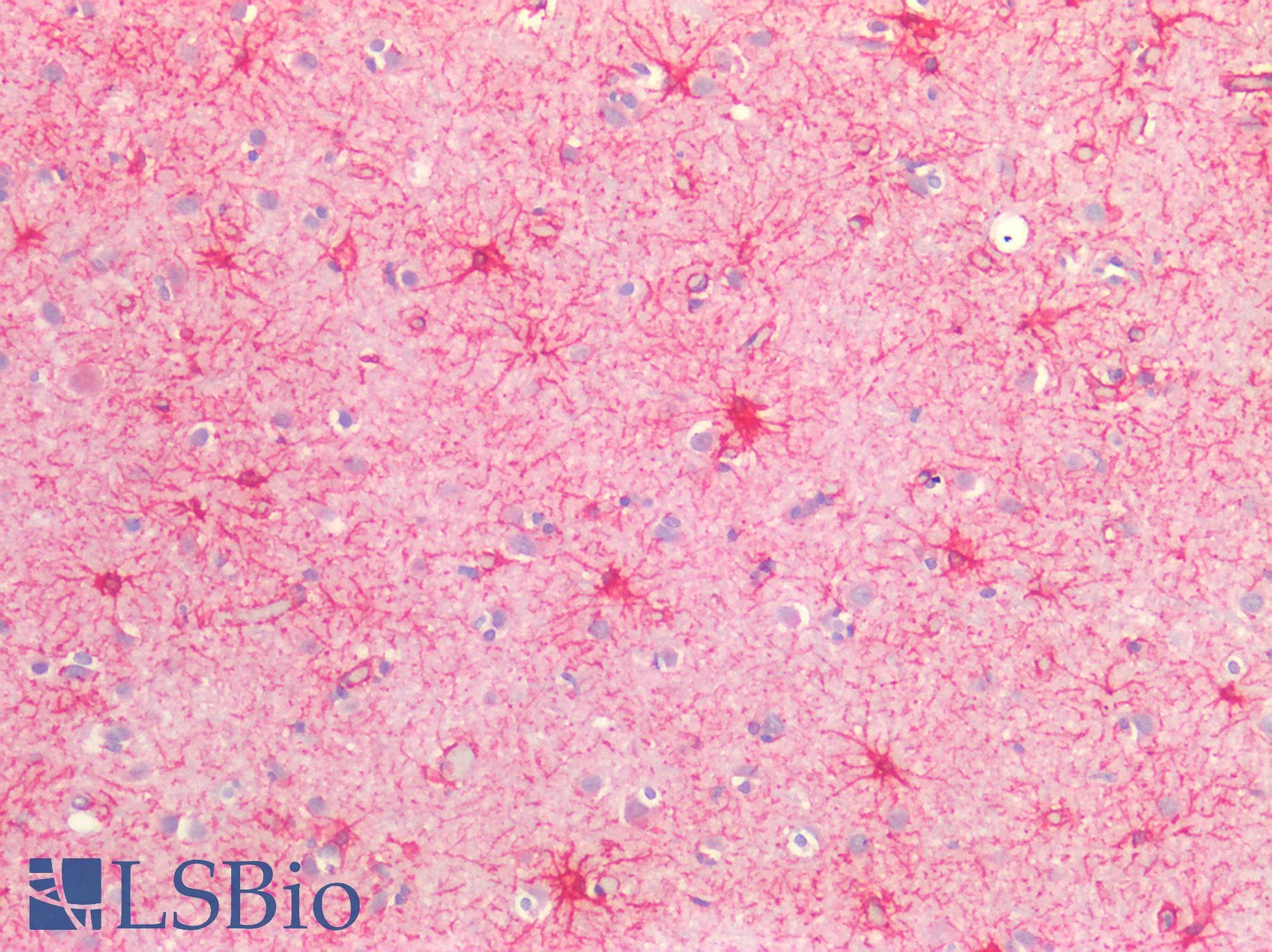 PathPlus™ SMAD3 Antibody