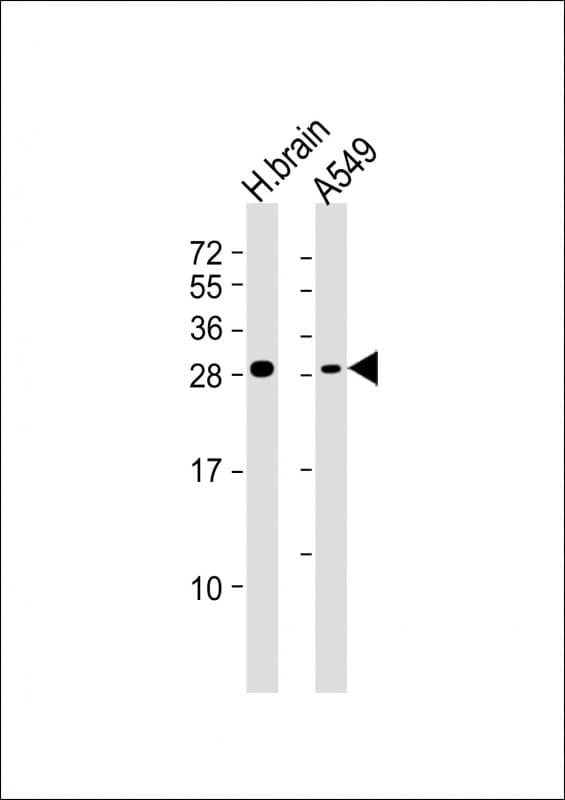 ASCL1 / MASH1 Antibody (Asp220, C-Terminal)