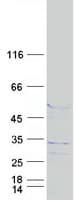 Human FAM71C Protein (Recombinant Myc-DDK (Flag))