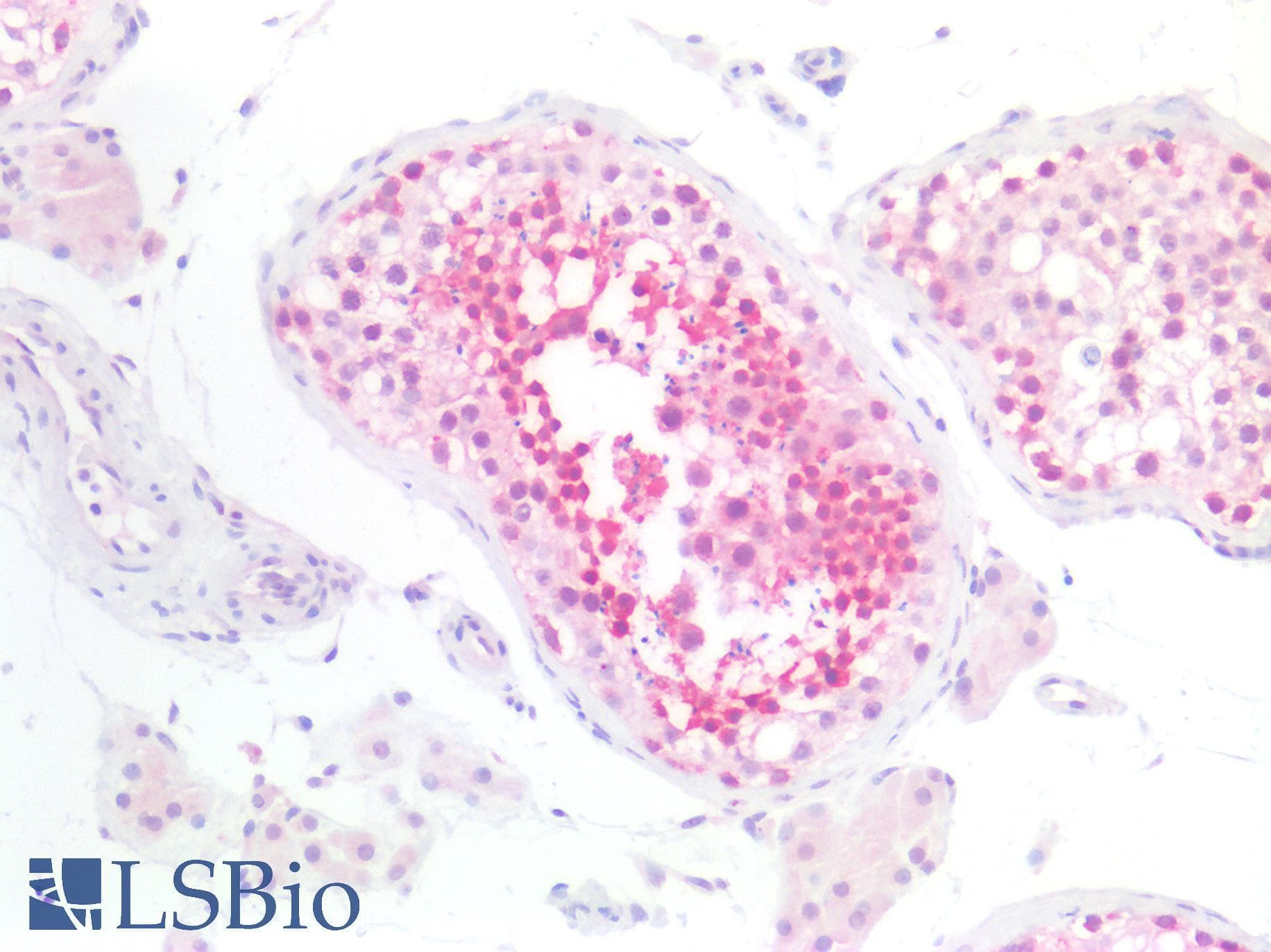 PathPlus™ STK11 / LKB1 Antibody