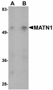 IHC-plus™ MATN1 / Matrilin 1 Antibody