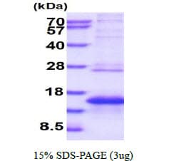 Human MLANA / Melan-A Protein (Recombinant His)