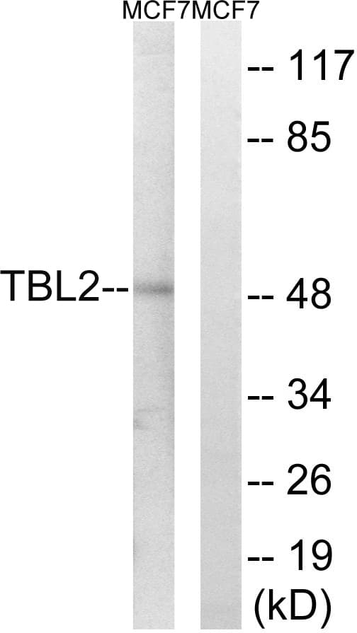 Polyclonal Rabbit anti-Human TBL2 Antibody (aa381-430, WB)