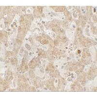 Polyclonal Rabbit anti-Human CCR7 Antibody (IHC, IF, WB)