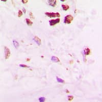 Polyclonal Rabbit anti-Human SENP5 Antibody (C-Terminus, IHC, WB)