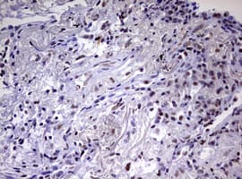 Monoclonal Mouse anti-Human CDCA7L Antibody (clone OTI1A12, aa1-337, IHC, WB)