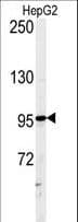 Polyclonal Rabbit anti-Human ATXN2L Antibody (aa1021-1048, WB)