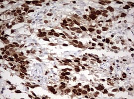 Monoclonal Mouse anti-Human TOP2A / Topoisomerase II Alpha Antibody (clone OTI2D12, aa1100-1531, IHC, WB)