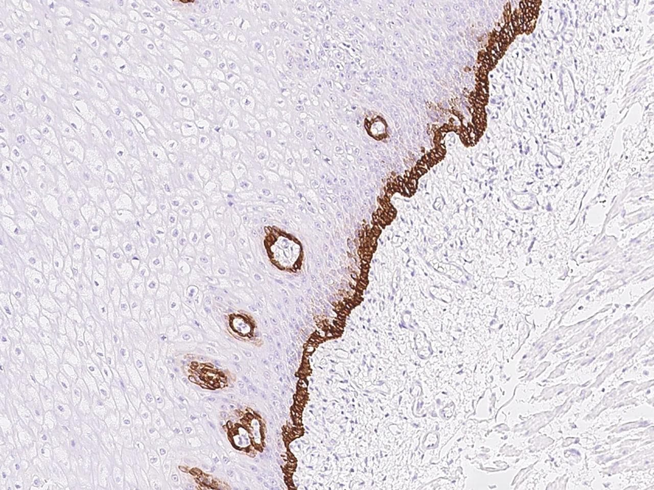 Polyclonal Rabbit anti-Human RAC3 Antibody (IHC)