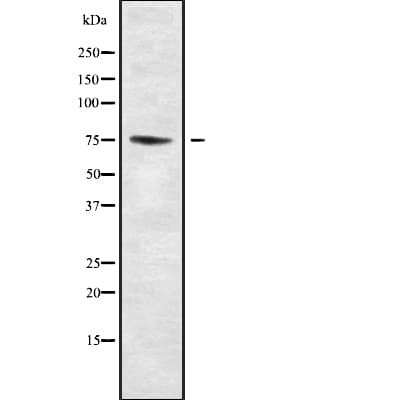 Polyclonal Rabbit anti-Human PAK6 Antibody (WB)