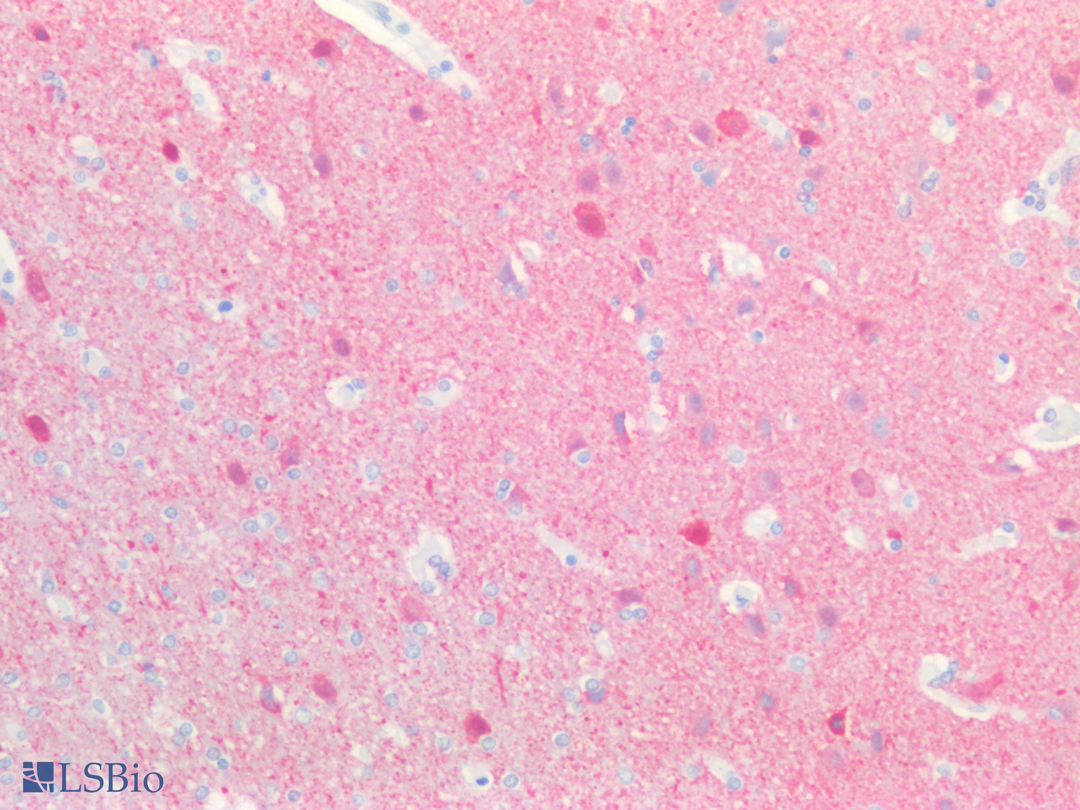 IHC-plus™ Polyclonal Goat anti-Human UCHL1 / PGP9.5 Antibody (aa58-68, IHC, WB)