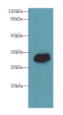 TMEM55A Antibody
