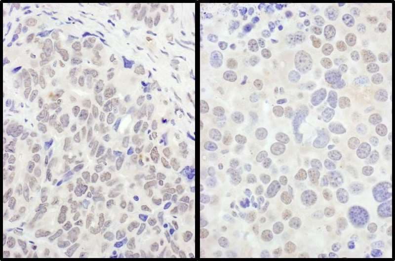 FOXO3 / FOXO3A Antibody (aa625-C-term)