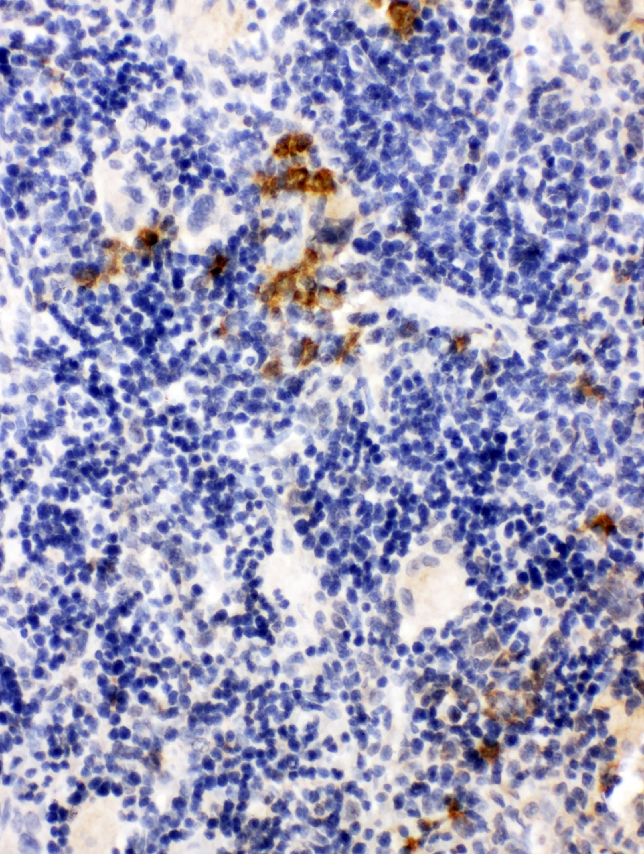 Polyclonal Rabbit anti-Human LPXN / Leupaxin Antibody (aa115-129, IHC, WB)