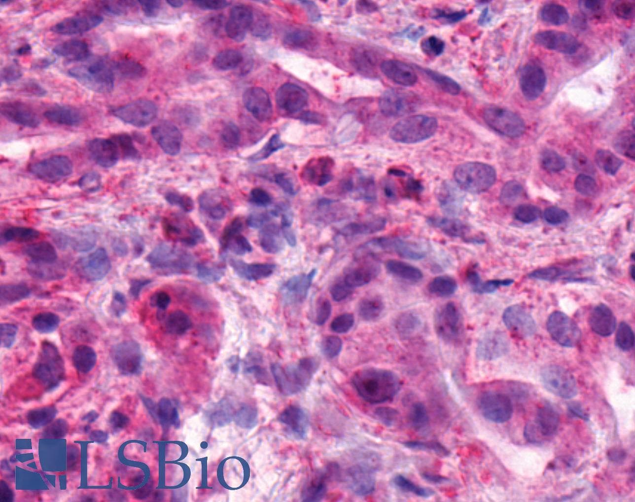 IHC-plus™ ADGRB1 / BAI1 Antibody (C-Terminus)
