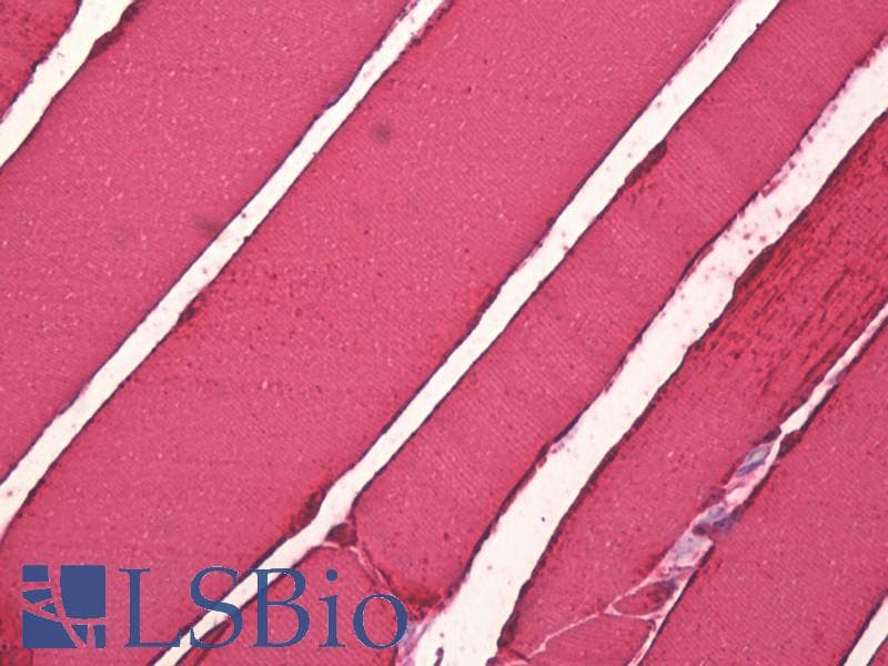 IHC-plus™ CKM / Creatine Kinase MM Antibody (aa10-59)