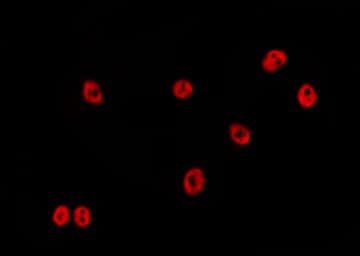 Polyclonal Rabbit anti-Human ZNF23 Antibody (IF, WB)