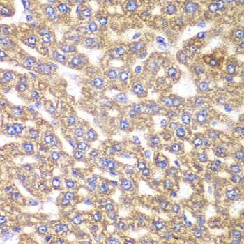 Polyclonal Rabbit anti-Human UGDH / UDPGDH Antibody (IHC, IF, WB)