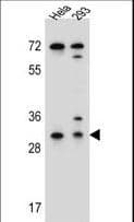 PathPlus™ Polyclonal Rabbit anti-Human EFNB2 / Ephrin B2 Antibody (aa157-186, IHC, IF, WB)