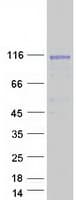 Human TPO / Thyroid Peroxidase Protein (Recombinant Myc-DDK (Flag))