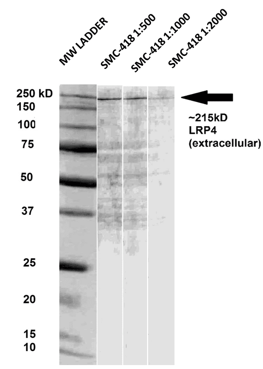 LRP4 Antibody (aa26-350, clone S207-27)