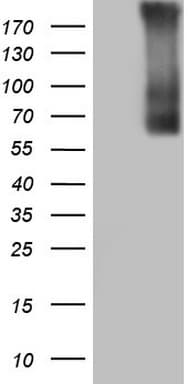 TG / Thyroglobulin Antibody (aa20-358, clone OTI8E6)