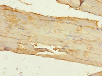 ITGA11 / Integrin Alpha 11 Antibody