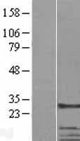 TBCB / CKAP1 Protein (Over-Expression Lysate Myc-DDK (Flag))