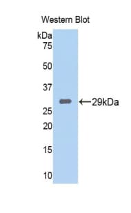Tpsb2 / Tryptase Beta 2 (Mouse Antibody (aa35-275)