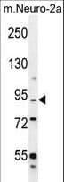 Polyclonal Rabbit anti-Human C1orf107 / DEF Antibody (aa2-30, IHC, IF, WB)