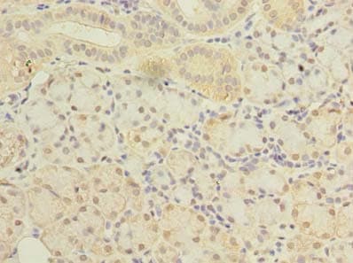 Polyclonal Rabbit anti-Human SLC38A2 / SNAT2 Antibody (aa1-76, IHC, WB)