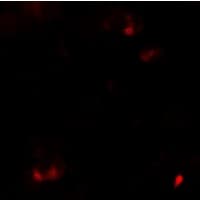 Polyclonal Rabbit anti-Human SAMSN1 Antibody (IHC, IF, WB)
