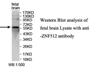 ZNF512 Antibody (aa16-268)