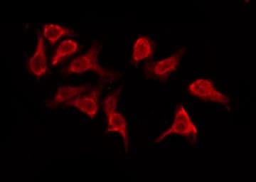 Polyclonal Rabbit anti-Human OR5M9 Antibody (IF, WB)