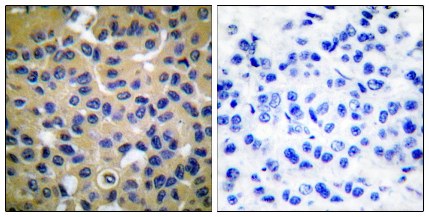 Collagen II Antibody