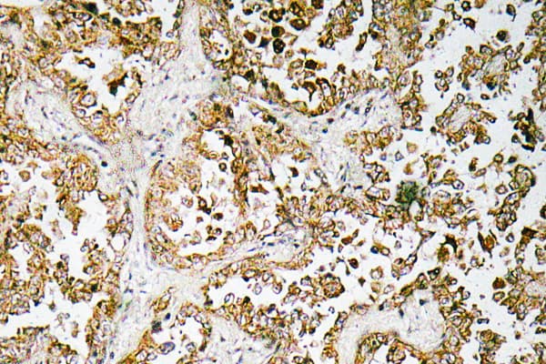 GATA5 Antibody (aa244-293)