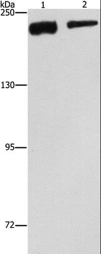 IHC-plus™ Polyclonal Rabbit anti-Human CLTC / Clathrin Heavy Chain Antibody (IHC, WB)