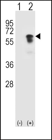 Polyclonal Rabbit anti-Human ALK2 / ACVR1 Antibody (aa132-162, IHC, WB)